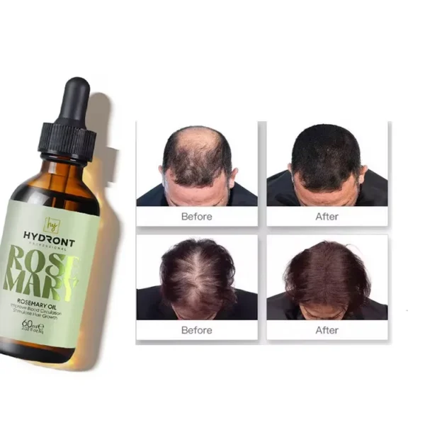 Kooswalla Fast Speed Organic Rosemary Oil Hair Growth for Baby Natural Hair Growth Oil Hair Growth Products